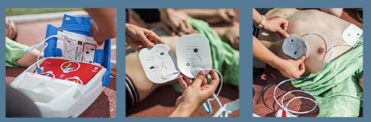 CARDİ ANGEL  OTOMATİK EKSTERNAL DEFİBRİLATÖR